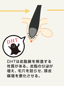 DHTは皮脂腺を刺激する性質がある。皮脂の分泌が増え、毛穴を詰らせ、頭皮環境を悪化させる。